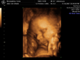 Thumbnail of baby_04.jpg