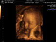 Thumbnail of baby_07.jpg