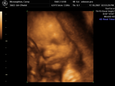 Thumbnail of baby_23.jpg